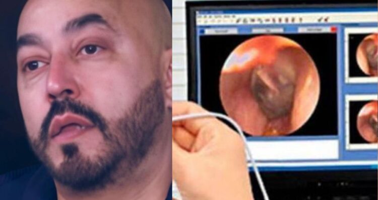Lupillo Rivera revela que perdió la audición de un oído