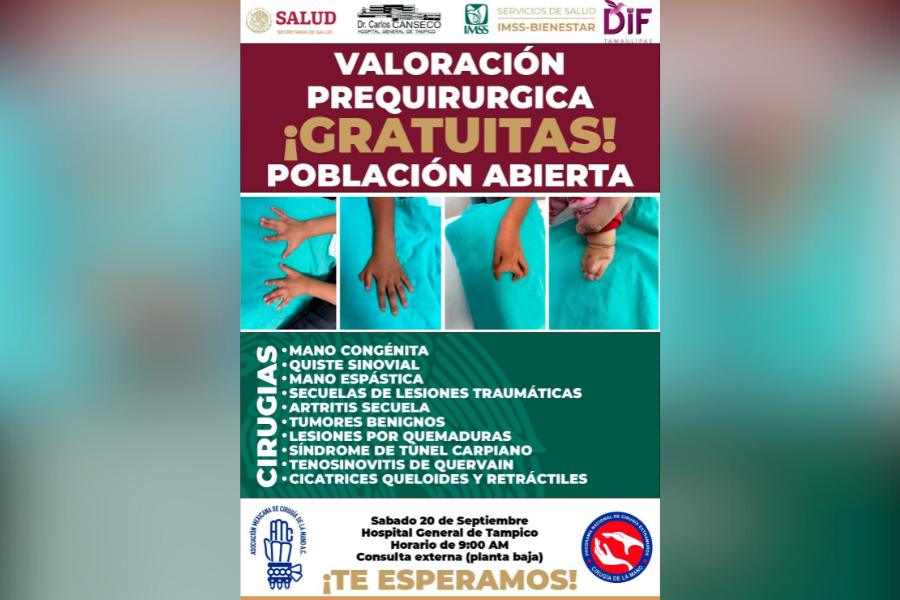 cirugías de mano gratis en tamaulipas