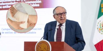 ¿Sufres de pie diabético IMSS-Bienestar implementa medicamento cubano para prevenir amputaciones en México