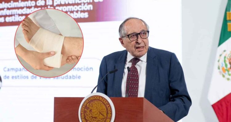 ¿Sufres de pie diabético IMSS-Bienestar implementa medicamento cubano para prevenir amputaciones en México
