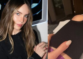 Belinda revela que fue hospitalizada por lesión en la rodilla