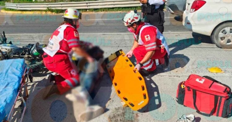 accidente motociclista amputación Victoria