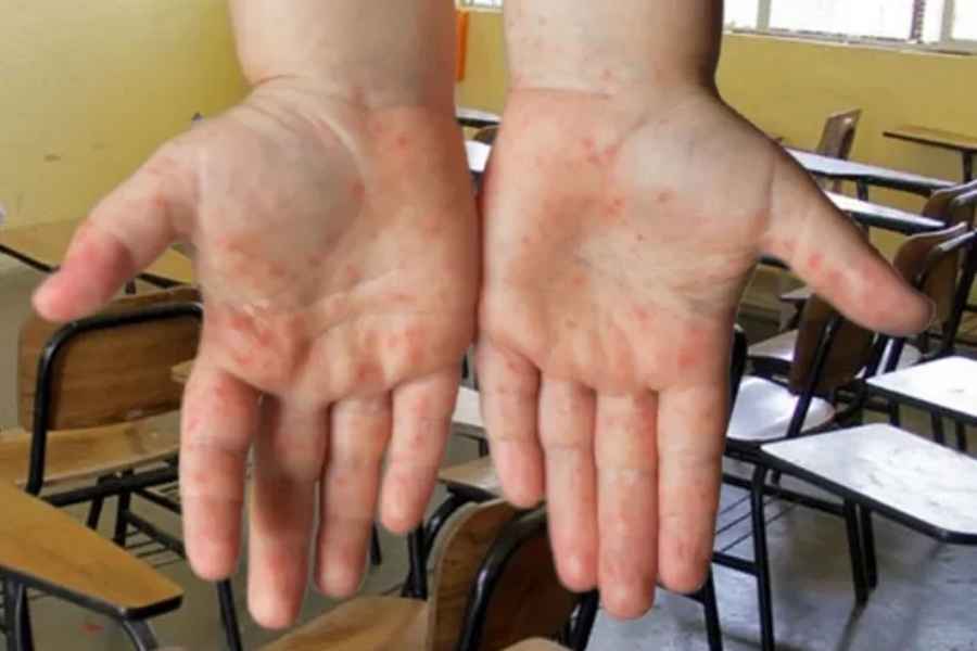 Sociedad de Maestros y Padres pide extremar limpieza en escuelas de Tamaulipas ante brote del virus “mano, pie, boca”