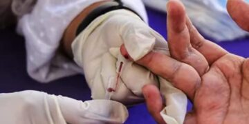 casos de VIH en Nuevo Laredo