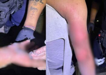 Lesionado por cohetón en Altamira