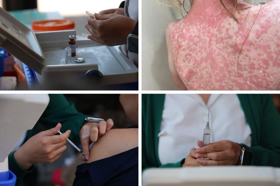 campaña de vacunación sarampión Tamaulipas