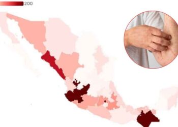 brote de sarampión en México