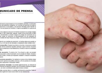 INE activa protocolo de prevención tras detectar caso de sarampión en uno de sus colaboradores