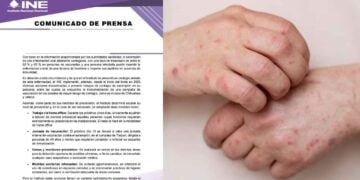 INE activa protocolo de prevención tras detectar caso de sarampión en uno de sus colaboradores