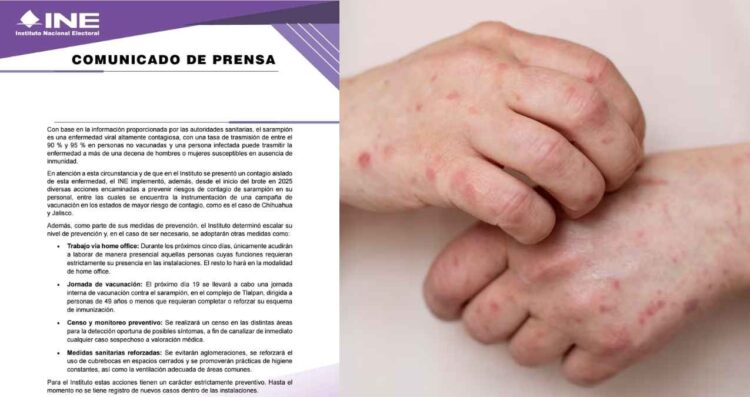 INE activa protocolo de prevención tras detectar caso de sarampión en uno de sus colaboradores