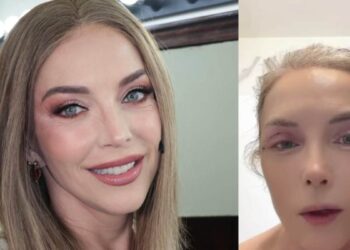 Laura Flores se somete a cirugía estética y explica cómo va su recuperación