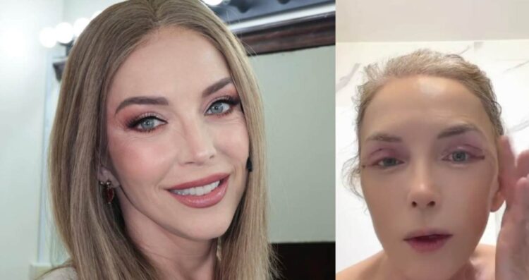 Laura Flores se somete a cirugía estética y explica cómo va su recuperación