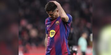 Lewandowski fractura orbital