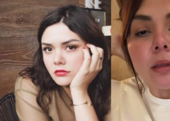 Yuridia revela que un tratamiento le dejó una cicatriz en el rostro