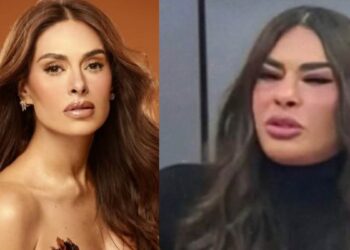 ¿Qué le pasó en el rostro a Galilea Montijo
