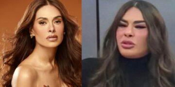 ¿Qué le pasó en el rostro a Galilea Montijo