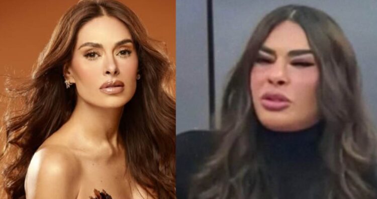 ¿Qué le pasó en el rostro a Galilea Montijo