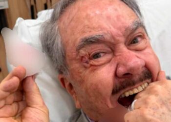 Pedro Sola preocupa a sus seguidores tras sufrir accidente
