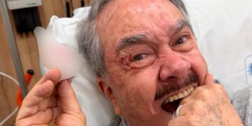 Pedro Sola preocupa a sus seguidores tras sufrir accidente