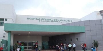 cirugías visuales en Matamoros