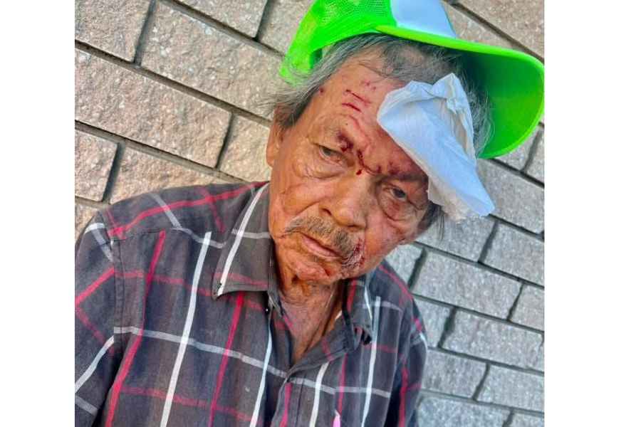 Adulto mayor atropellado en Victoria (1)
