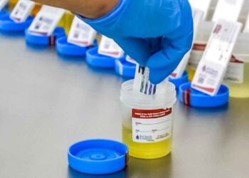 PVEM iniciativa prueba antidoping