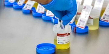PVEM iniciativa prueba antidoping