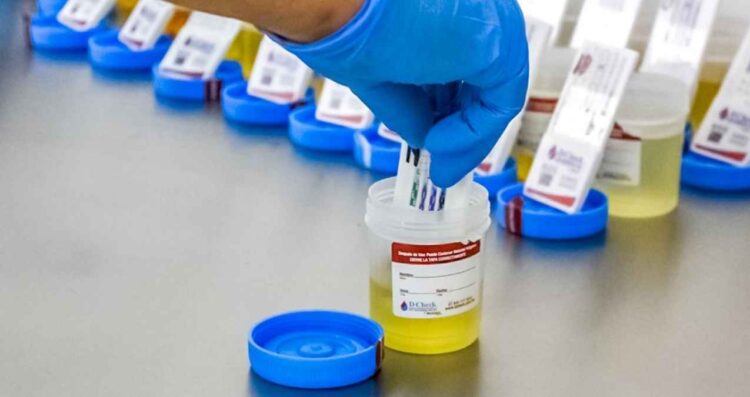 PVEM iniciativa prueba antidoping