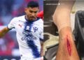 Orbelín Pineda herida de su pierna