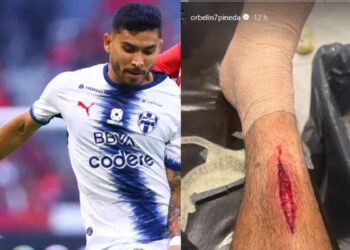 Orbelín Pineda herida de su pierna