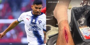 Orbelín Pineda herida de su pierna