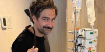 Alfonso Herrera cirugía 