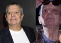 César Bono ojo cirugía