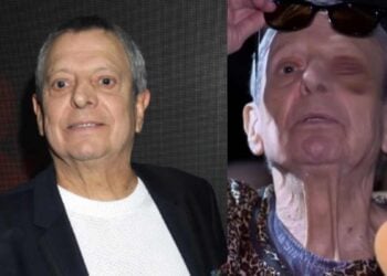 César Bono ojo cirugía