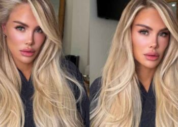 Ninel Conde cambio en el rostr