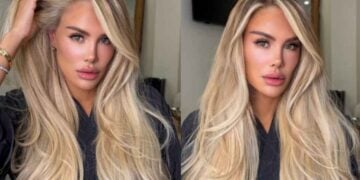 Ninel Conde cambio en el rostr