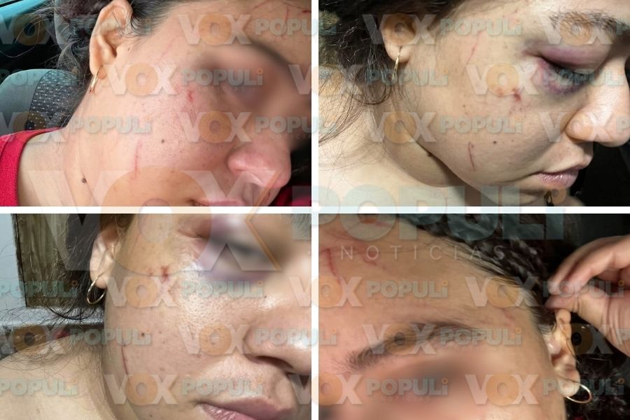 agresión a mujer en Ciudad Madero